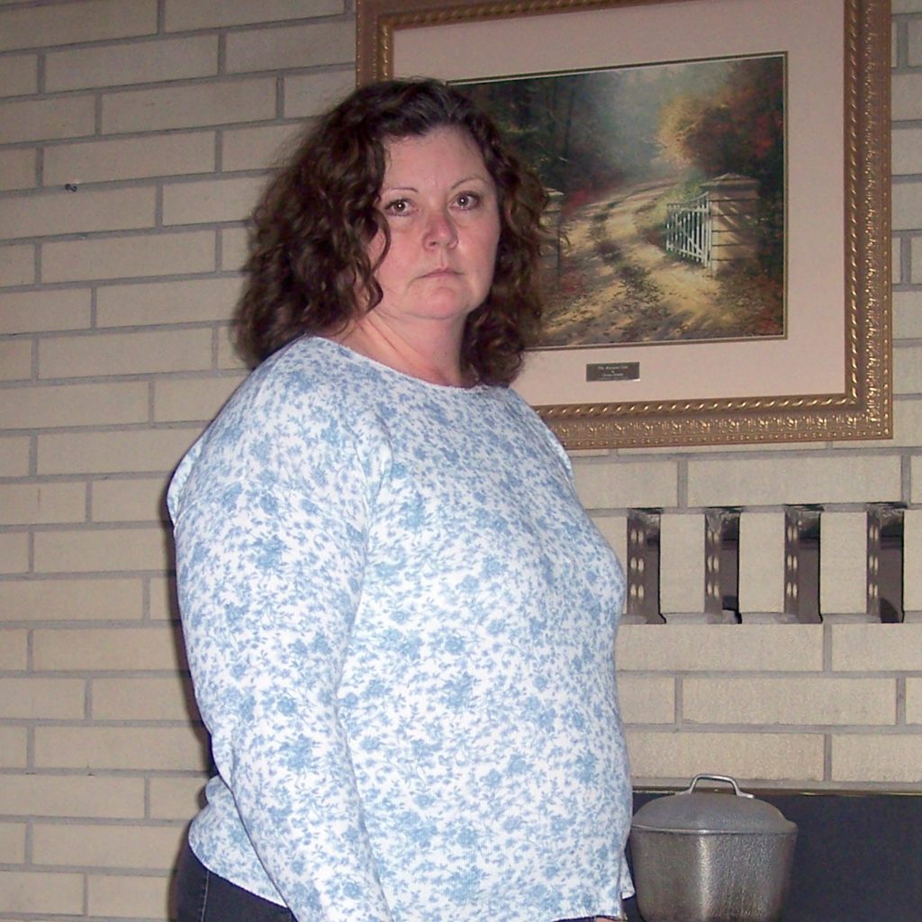 Judi success story - before photo